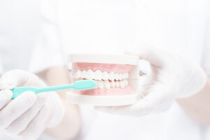 インプラント患者のための歯周病予防ガイド